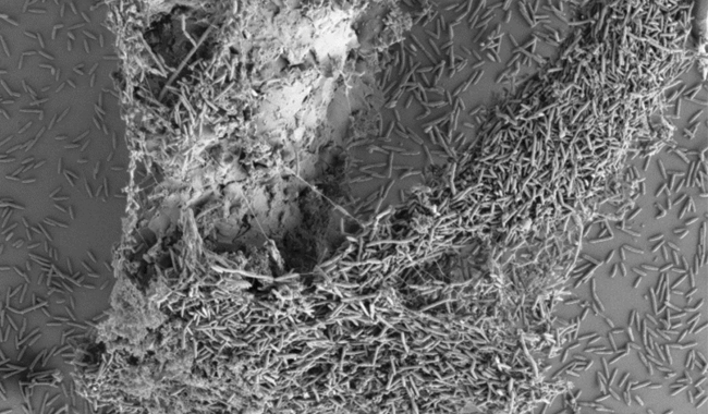 MT Nov 15 campylobacter biofilm splinter