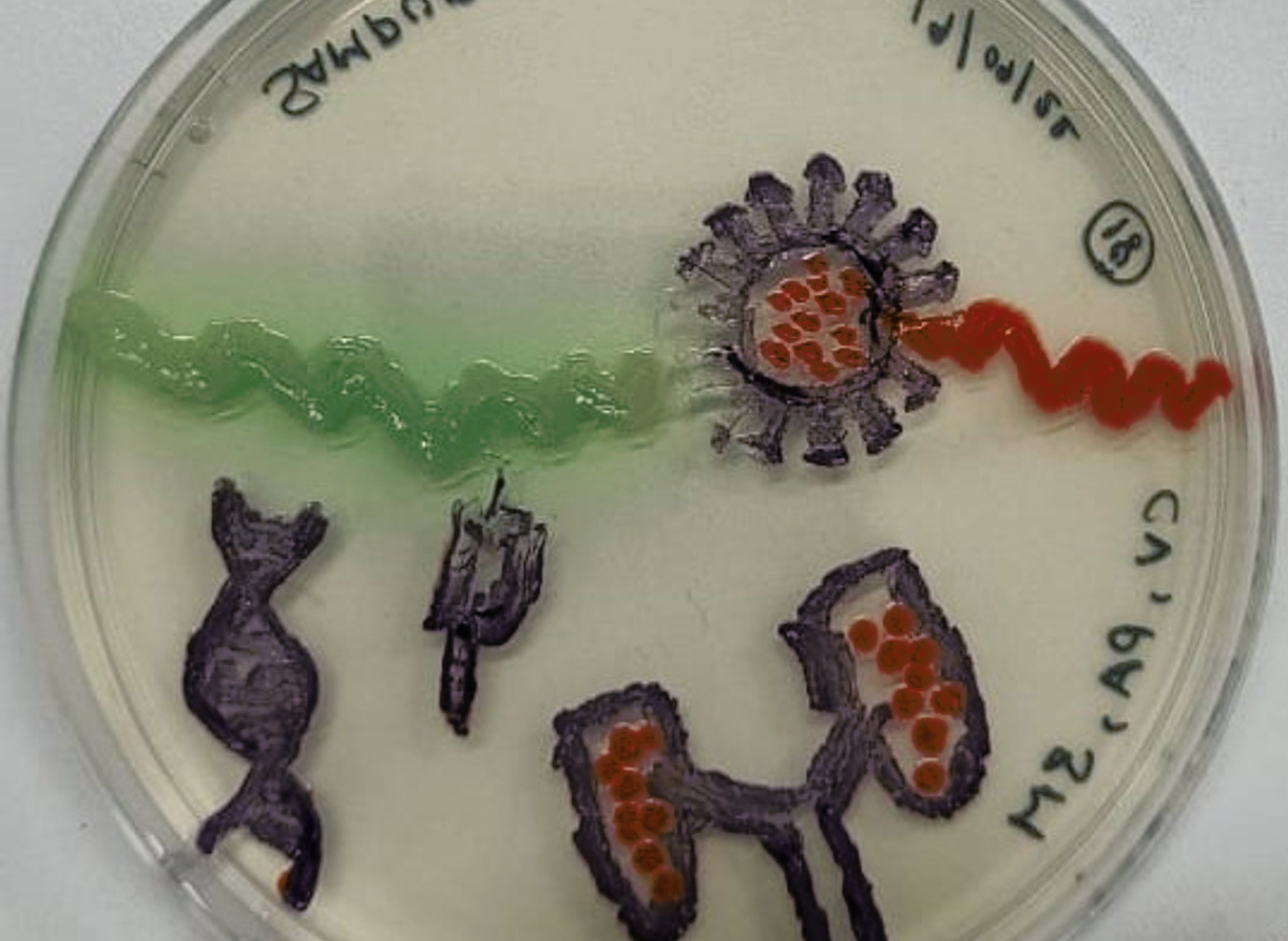 Agar art plate 2