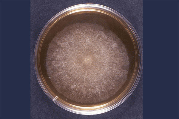 An example of fungal mycelium