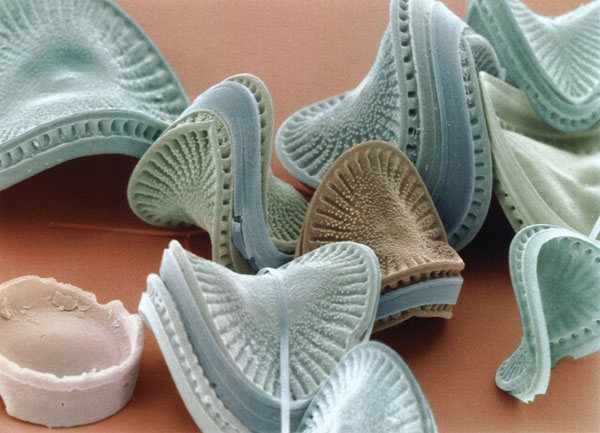 MT Feb 2014 Diatom - Campylodiscus