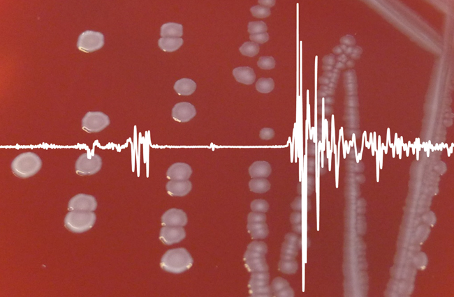 MT Aug 15 infrared bacterial fingerprint