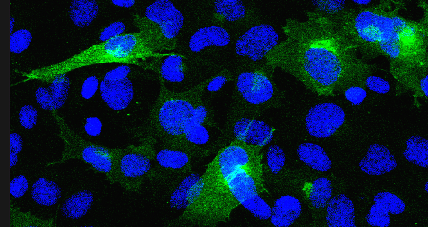 Bluetongue virus-infected sheep cells